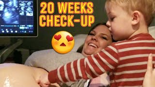 20 WEEKS BABY CHECKUP 🤰😍 [upl. by Yziar]