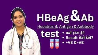 HBeAg and Antibodies Test in Hindi  Positive Negative Result Analysis [upl. by Neltiac]