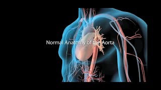 Aortic Aneurysm and Aortic Dissection [upl. by Rafa]