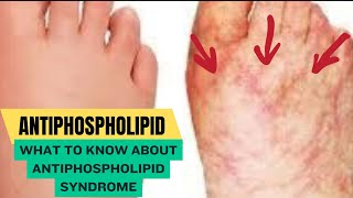 Antiphospholipid Syndrome [upl. by Valaree]