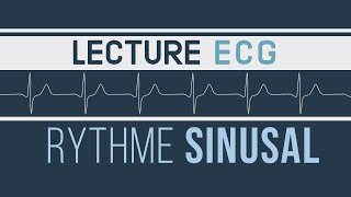 Interprétation ECG  Rythme Sinusal [upl. by Trip]