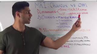 MRI Differentiating Charcot Neuroarthropathy vs Osteomyelitis [upl. by Lazos539]