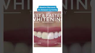 The BEST Amazon Deals🔥 Crest 3D Whitestrips with Light Whitestrips coupons [upl. by Karilla]