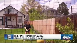 Medical Moment Helping hip dysplasia [upl. by Wilcox]