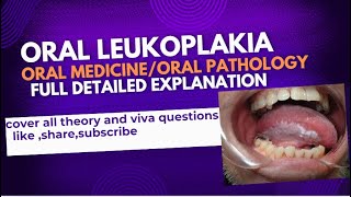 oral leukoplakia etiology clinical featurediagnosisdifferential diagnosis treatment [upl. by Lleznov]