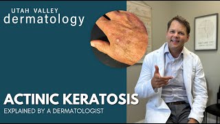 Actinic Keratosis Explained by a Dermatologist  Utah Valley Dermatology [upl. by Edahc]