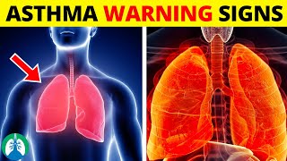 Top Early Warning Signs of Asthma That You Should NEVER IGNORE [upl. by Llorrad]