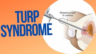 TransUrethral Resection Syndrome TURP SYNDROME [upl. by Stace]