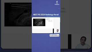 NEET PG 2024 Radiology Recall by Dr Zainab Vora  Cerebellum Academy [upl. by Sirc]