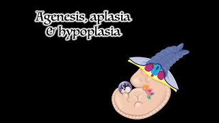 Agenesis Aplasia and Hypoplasia [upl. by Retse]