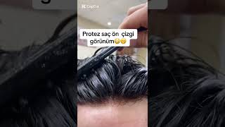 protezsaç değişim barber sackesimi hair protezsac hairstyle barbershop [upl. by Bernat]