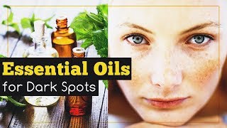 Essential Oils for Dark Spots on Face [upl. by Tindall125]