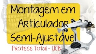 Prótese UCB  Montagem no Articulador SemiAjustável [upl. by Siugram]