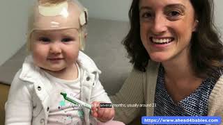 Newborn Misshapen Head Positional Plagiocephaly Treatment [upl. by Alla]