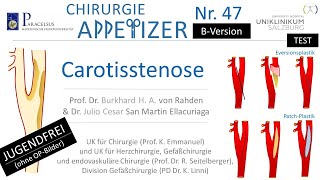 Carotisstenose CHIRURGIE APPetizer Nr 47 BVERSION ohne OPBilder [upl. by Persons]