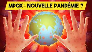 MPOX  La PROCHAINE pandémie   Variole du singe  Monkeypox [upl. by Rambort]