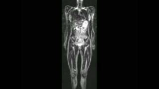 Full Body MRI [upl. by Ygief]