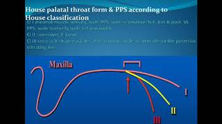 Prosthodontics L5 Posterior Palatal Seal Area [upl. by Eromle]