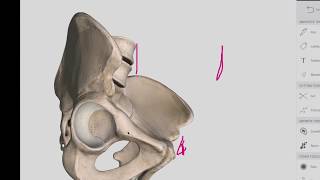 Hip Bone  Anatomy  Easy [upl. by Ativad]