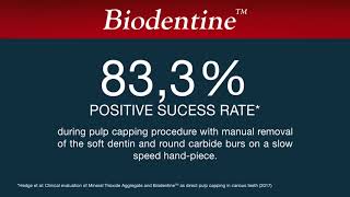 Biodentine in Atraumatic Restorative Treatment ART [upl. by Hartmann]