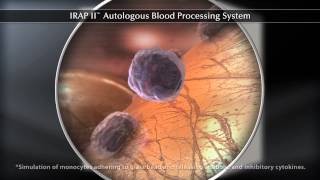 IRAP II™ Autologous Blood Processing System [upl. by Arly485]