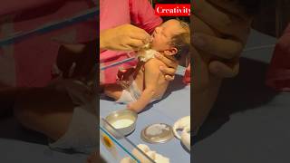 Newborn Baby katoori Spoon Feeding nicu medical viral [upl. by Ledba]