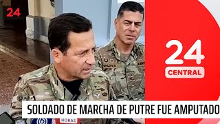 Soldado de la marcha de Putre fue amputado  24 Horas TVN Chile [upl. by Elbert]