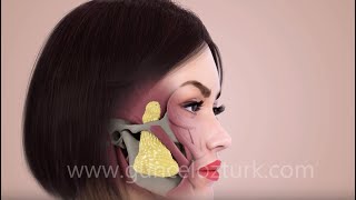 Bichectomy Fat Removal From The Cheek  Nefertiti Cheek  How is it done Guncel Ozturk MD [upl. by Dlanar]