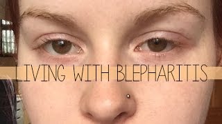 Living with Blepharitis [upl. by Oxford]