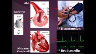 Calcium Channel Blocker CCB Toxicity quotEM in 5quot [upl. by Simonsen582]