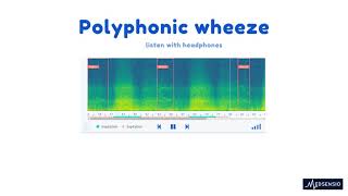 Lung sounds  polyphonic wheeze [upl. by Brookhouse]