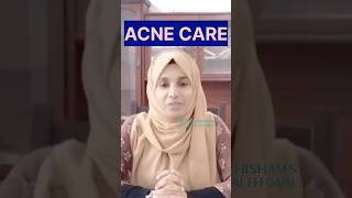 മുഖക്കുരു മാറാൻ ഇങ്ങനെ ചെയ്താൽ മതി  Pimples Home remedies Malayalam pimples acne [upl. by Sezen]