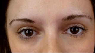 Women Turn to Eyebrow Transplants for Fuller Brows [upl. by Ttergram]