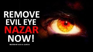 REMOVE EVIL EYE NOW  Very Powerful  MUST WATCH [upl. by Tamah]