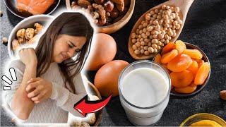 What Food to Avoid For Eczema  Foods To Avoid For Eczema [upl. by Kcirderf203]