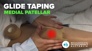 Medial Patellar Glide Taping [upl. by Binah706]