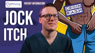 How To Recognise And Treat JOCK ITCH A Doctors Guide With PHOTOS and Home Treatment [upl. by Olsson]