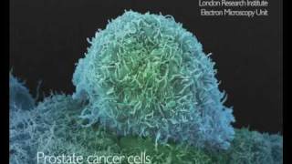 Electron microscopy of cancer cells from Cancer Research UKfunded scientists [upl. by Eerahc]