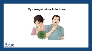 Cytomegalovirus Infections [upl. by Ivens]