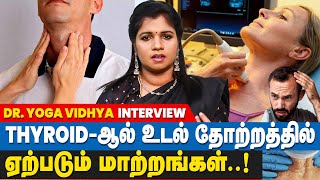 Thyroid இருந்தால் பெண்களுக்கு அதிகமா பிரச்சனைகள் ஏற்படும்  DrYoga Vidhya Interview T3 T4 and TSH [upl. by Porush]