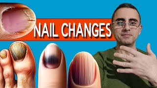 Nails as Health Indicators Top 13 Nail Changes [upl. by Lednew]