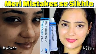 Watch This Before Starting Tretinoin—My Biggest Mistakes Revealed  Indian Youtuber Anmol [upl. by Anyalram172]