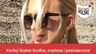 KurdejSzatan brudna zraniona i posiniaczona Co się dzieje [upl. by Corissa142]