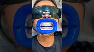 Whitening Teeth cream teeth shortvideo shortsart shorts [upl. by Scandura]