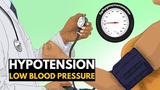 Low Blood Pressure or Hypotension Causes Signs and Symptoms Diagnosis and Treatment [upl. by Dotti188]