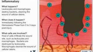 Wound Healing Process [upl. by Sorci]