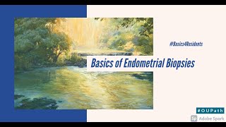 Basics of Endometrial Biopsies Tutorial for Residents [upl. by Oaoj470]