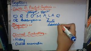 PROPTOSIS very important topic with MNEMONICS to learn part 2 [upl. by Hannaj]