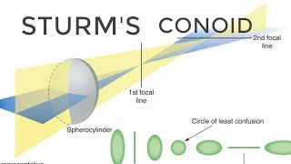 Sturms Conoid and shape of bundle of light rays at different levels [upl. by Edny]