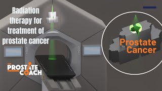 External beam radiation for treatment of prostate cancer [upl. by Aromas]